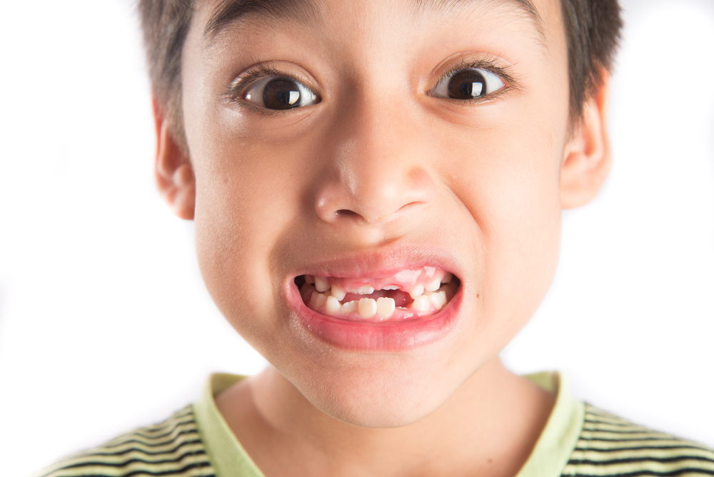 salud bucodental en niños