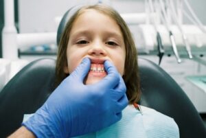 Frenillo labial superior