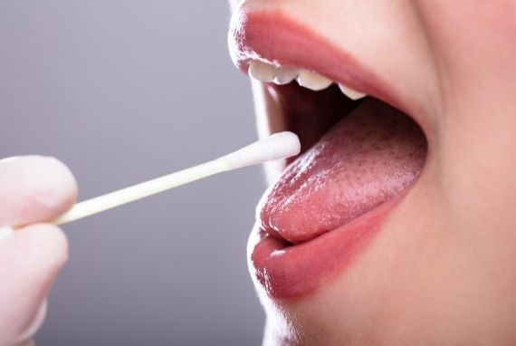 La importancia de la saliva para la salud bucodental