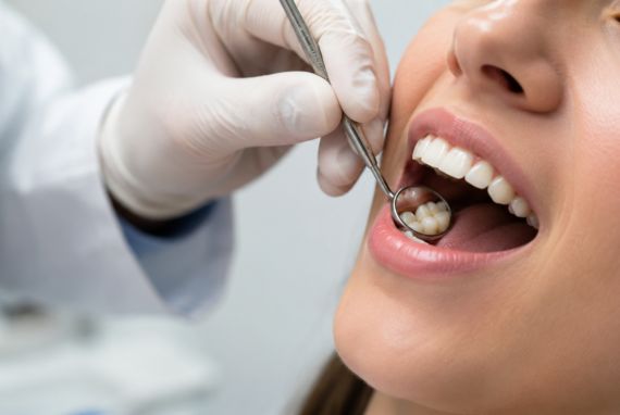 caries entre dientes