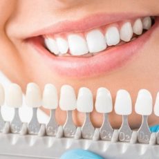 fundas dentales