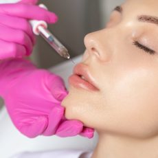 Aplicación novedosa del ácido hialurónico en estética dental