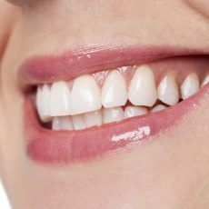 Erosión dental